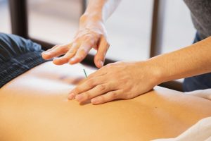Imagen de una sesión de acupuntura realizada en la espalda de una mujer. La práctica de la acupuntura se muestra en acción, destacando la técnica terapéutica para aliviar dolencias físicas y promover el bienestar.