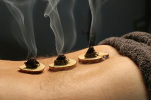 Imagen de una sesión de moxibustión japonesa, una antigua técnica de estimulación de puntos específicos en el cuerpo para mejorar la circulación y aliviar dolencias, utilizado en la medicina alternativa japonesa.