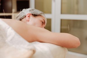 Acupuntura como tratamiento natural para el cáncer, una terapia complementaria para aliviar el dolor y el estrés.