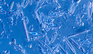 Diatomeas, un tipo de fitoplancton crucial para la vida submarina y el desarrollo sostenible